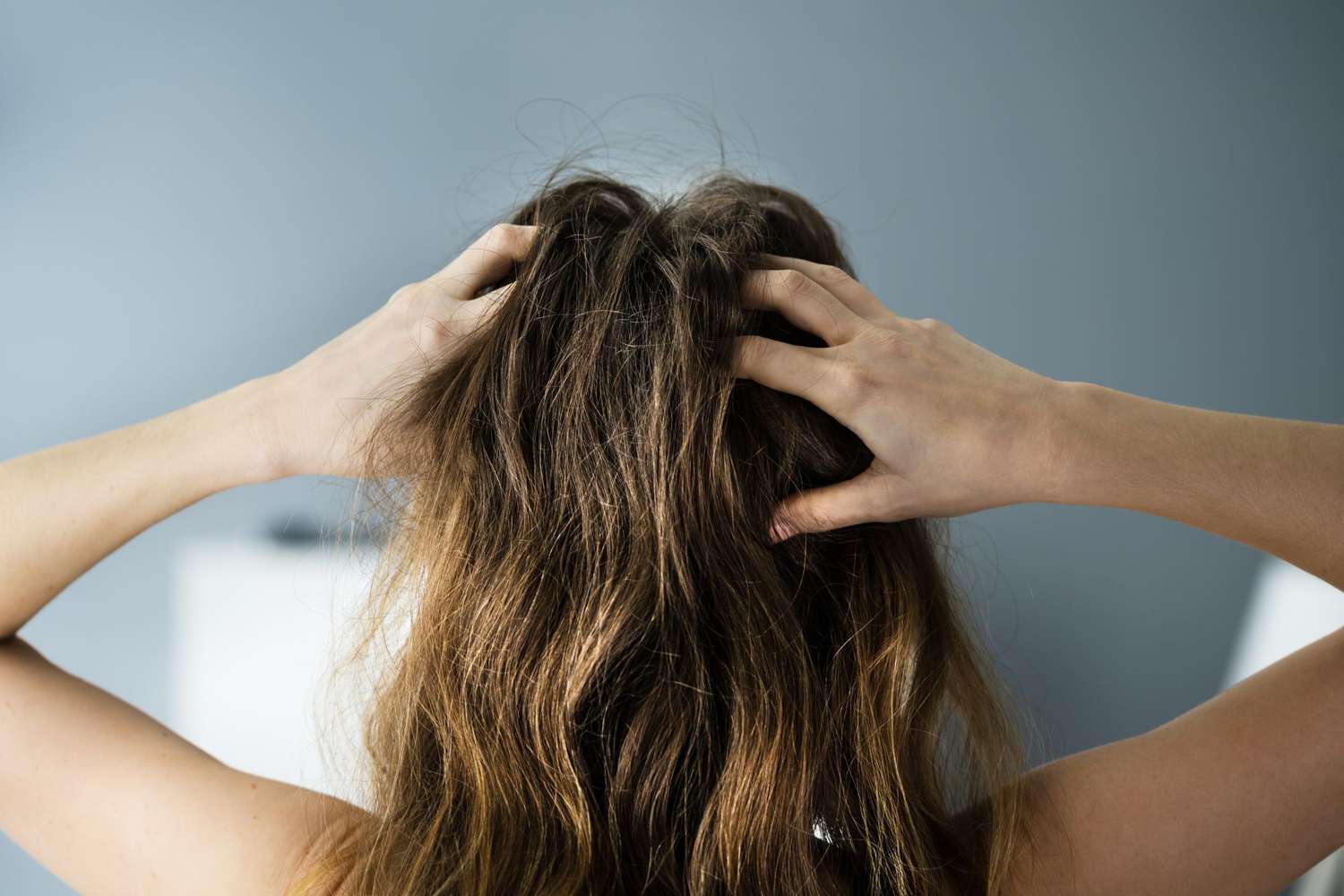 The Causes of Hair Loss at the Crown&mdash;Plus, What to Do About It, According to Experts